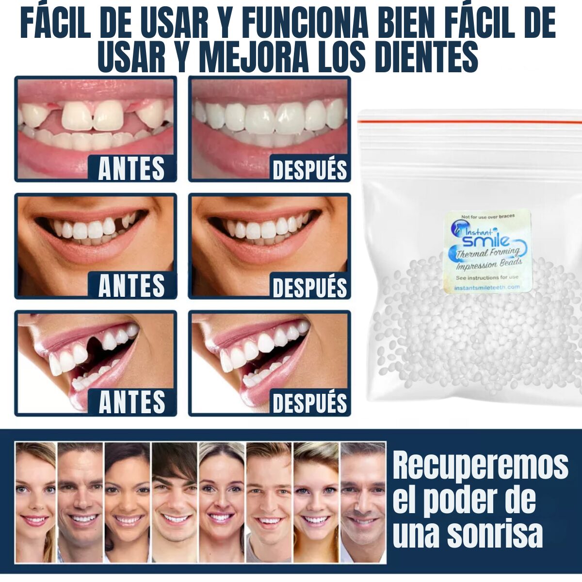 InstantSmile™ | Kit Premium Prótesis Dental Moldeable