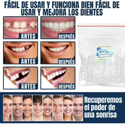 InstantSmile™ | Kit Premium Prótesis Dental Moldeable