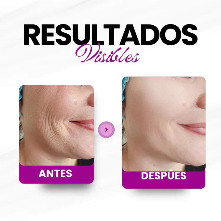 Microingredients® | Multi Colágeno Peptides Premium 🌿