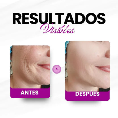 Microingredients® | Multi Colágeno Peptides Premium 🌿