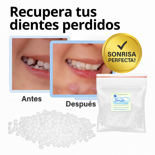 InstantSmile™ | Kit Premium Prótesis Dental Moldeable